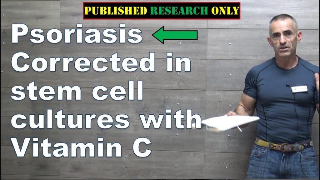 Psoriasis Corrected in stem cell cultures with Vitamin C